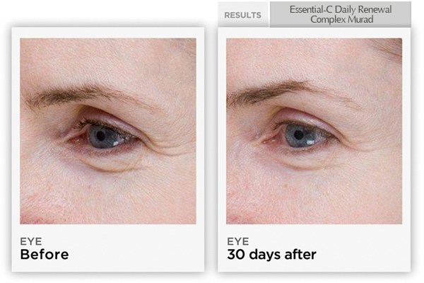 Kết quả sau khi sử dụng kem dưỡng tái tạo da Murad Essential-C