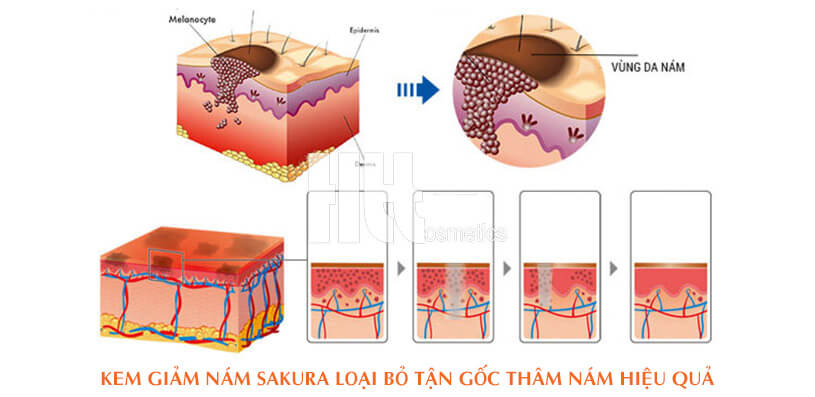 Kem dưỡng trắng da trị nám ban ngày cao cấp Sakura Whitening Day SPF 50 - Hoa Thien Thao Cosmetics