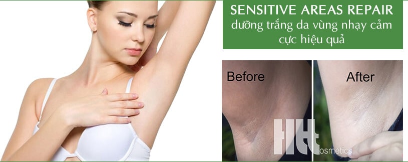 Kem dưỡng trắng da vùng nhạy cảm bella belle Sensitive Areas Repair - Hoa Thiên Thảo