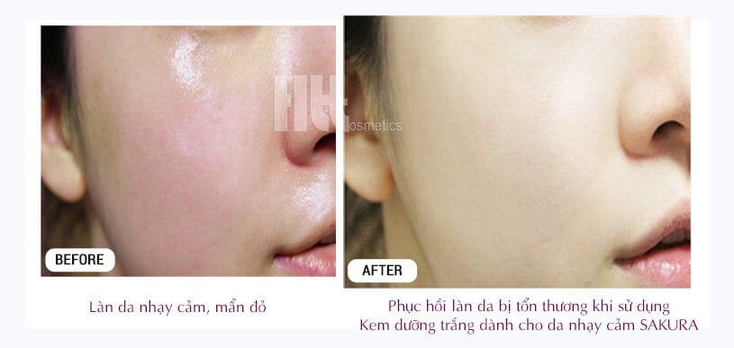 Kem dưỡng trắng dành cho da nhạy cảm Sakura Botanical Sensitive - Hoa Thiên Thảo