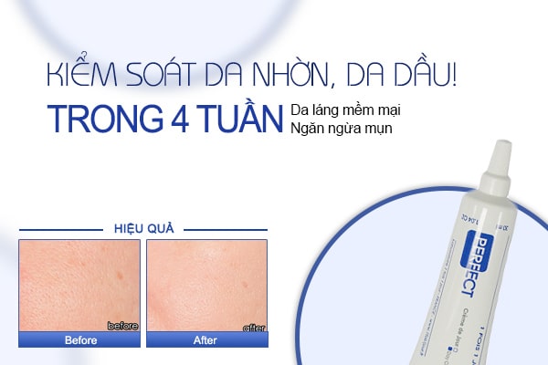 Hiệu quả kem kiểm soát nhờn Perfect có thể khác nhau tùy theo thể trạng và cơ địa
