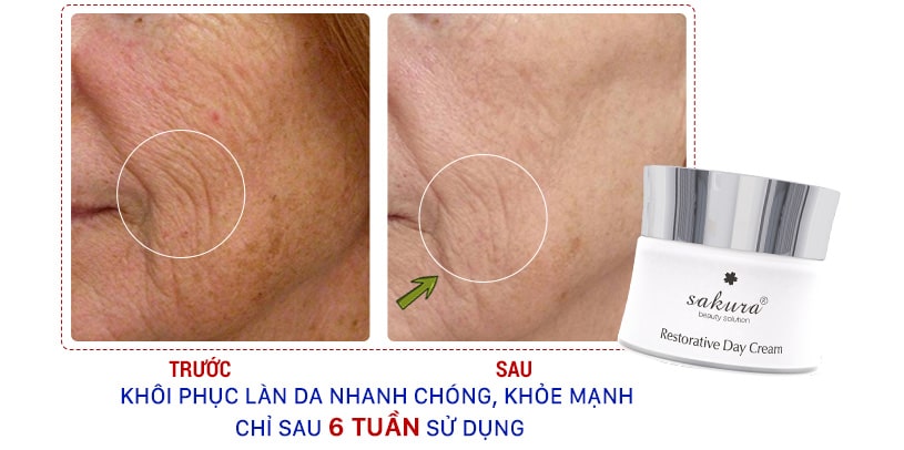 Kem phục hồi da chống lão hóa ban ngày Sakura Restorative