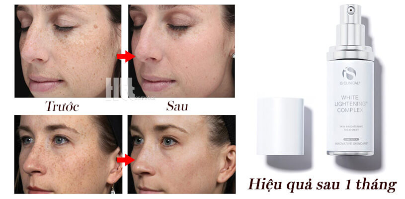 Kem trị đốm nâu iS Clinical White Lightening Complex - HoaThienThao