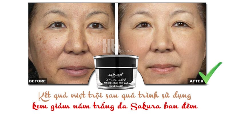 Kem trị nám trắng da Sakura ban đêm Whitening Night Cream - Hoa Thiên Thảo