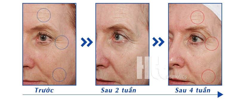 Serum chống lão hóa da iS Clinical Genexc - Hoa Thiên Thảo