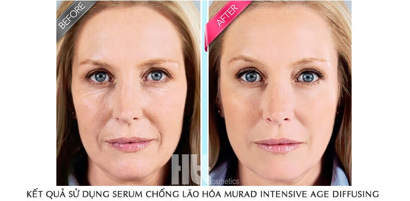 Serum chống lão hóa phục hồi da Murad Intensive Age Diffusing - Hoa Thiên Thảo