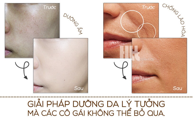 serum dưỡng ẩm và chống lão hóa tức thì Martiderm Flash - Hoa Thiên Thảo