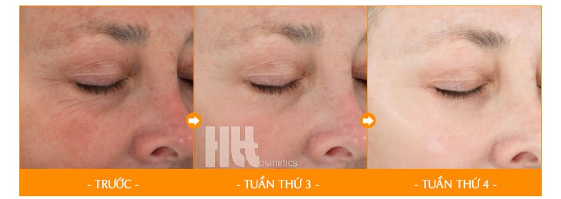 Serum giảm nám dưỡng trắng da iS Clinical C&E Advanced - Hoa Thiên Thảo