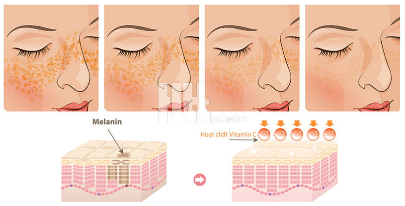 Serum giảm nám dưỡng trắng da Mesoestetic Ampollas Vitamin C - Hoa Thiên Thảo