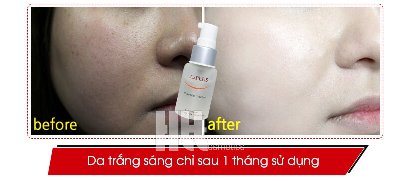 Serum trắng da A&Plus Whitening Essence A005 - Hoa Thiên Thảo