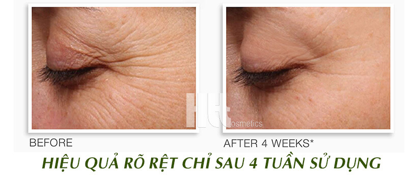 Serum xóa nếp nhăn vùng mắt Murad Retinol Youth Renewal - HoaThienThao