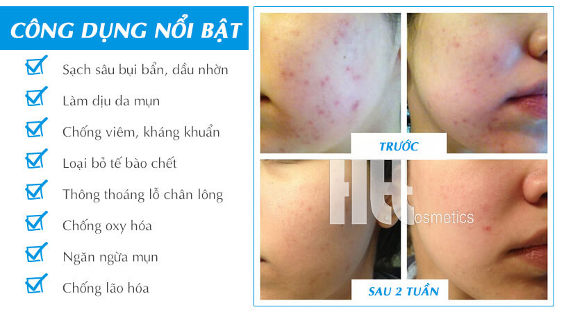 Sữa rửa mặt Murad Clarifying Cleanser cho da mụn - Mỹ Phẩm Hoa Thiên Thảo