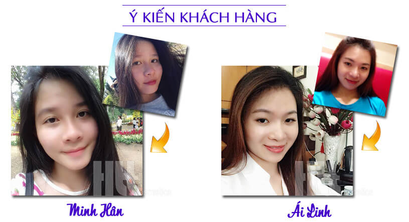 Sữa rửa mặt Sakura cho da nhạy cảm - Mỹ Phẩm Hoa Thiên Thảo