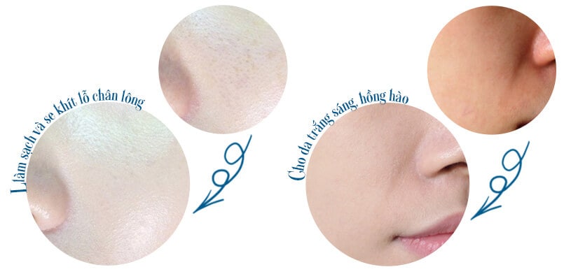  sữa rửa mặt tạo bọt là gì Micellar MartiDerm - Hoa Thiên Thảo