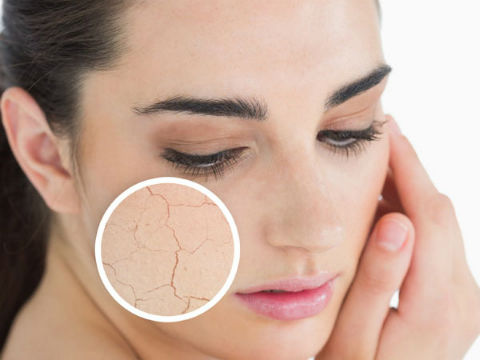 Da khô, nhăn nheo thể hiện rõ tuổi tác của bạn