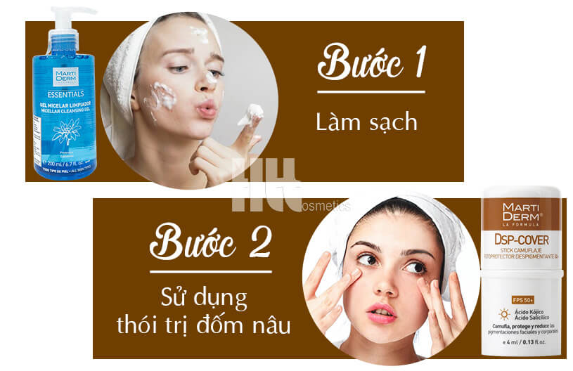 Thỏi ngăn ngừa và điều trị đốm nâu Martiderm DSP-Cover Stick - Hoa Thiên Thảo