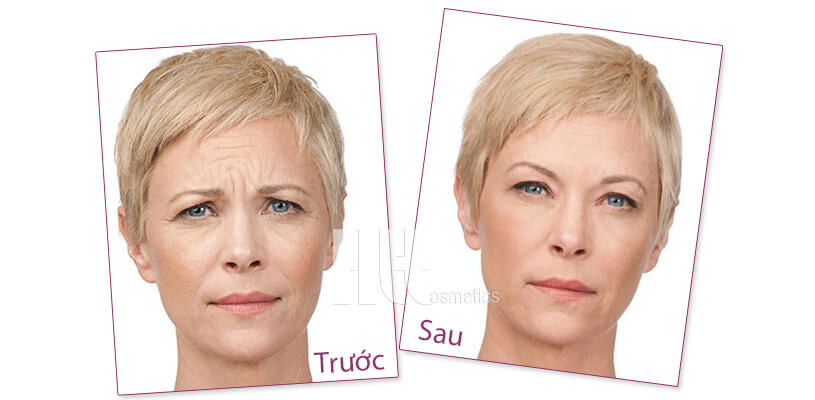 Tinh chất collagen trẻ hóa da Murad Rapid Collagen Infusion - Hoa Thiên Thảo