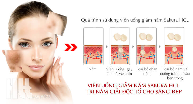 Viên uống trị nám Sakura HCL EX - Công ty mỹ phẩm Hoa Thiên Thảo